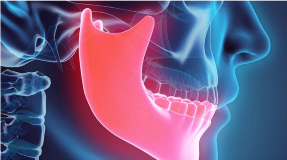 Ilustración anatómica maxilofacial para el congreso de ortodoncia